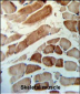 MMAA Antibody (N-term)